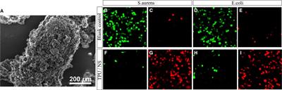 Effect of Silver Nanoparticles With Thermoplastic Polyurethane on Postoperative Rehabilitation of Diabetic Patients With Open Fracture of Lower Extremities